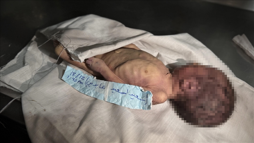 Gazze-de-iddetli-so-uk-nedeniyle-bir-ayl-k-bebek-hayat-n-kay