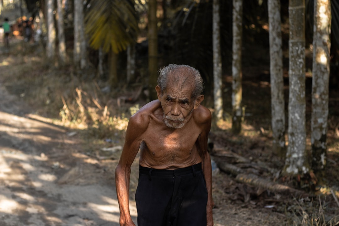 70 Yaşındaki Hasta Robotik Diz Protezi Cerrahisiyle İyileşti