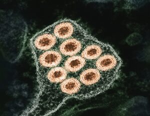 Nipah Virüsü Nedir, Nasıl Bulaşır ve Tedavisi Var mı?