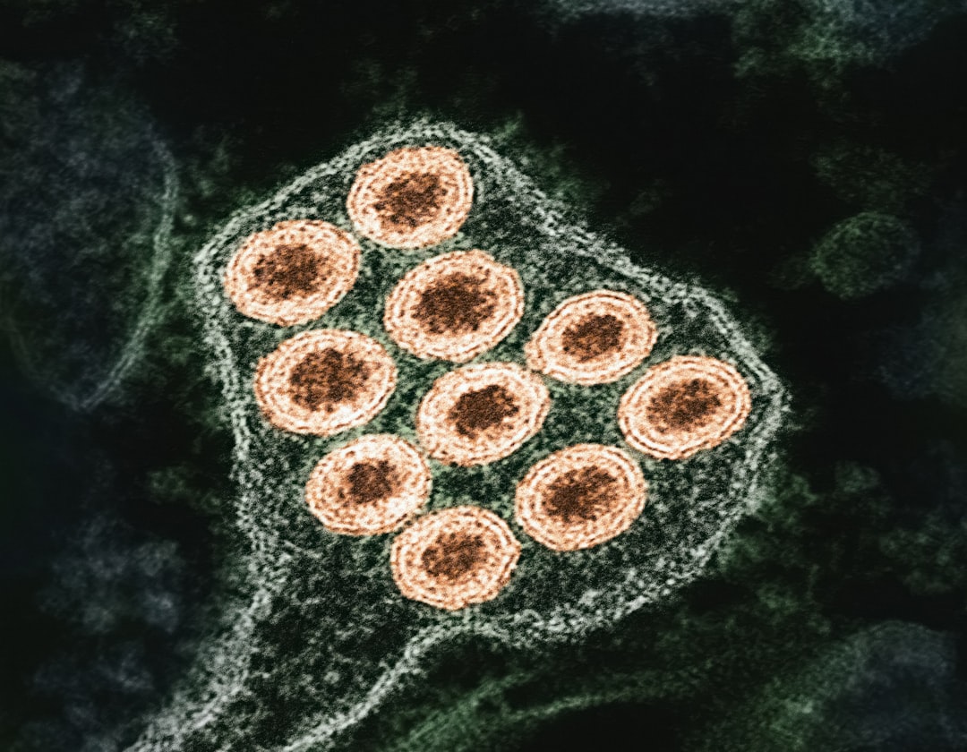 Nipah Virüsü Nedir, Nasıl Bulaşır ve Tedavisi Var mı?